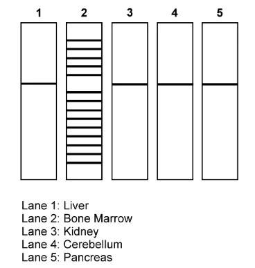 USMLE question #469 exhibit