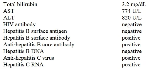 USMLE question #573 exhibit