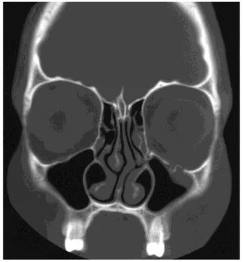 USMLE question #551 exhibit
